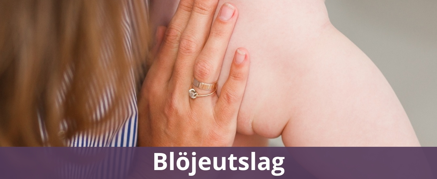 Blöjeutslag