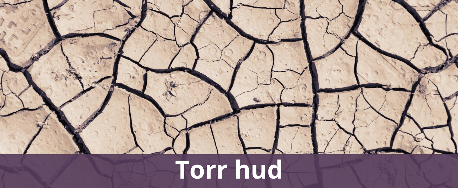 Torr hud