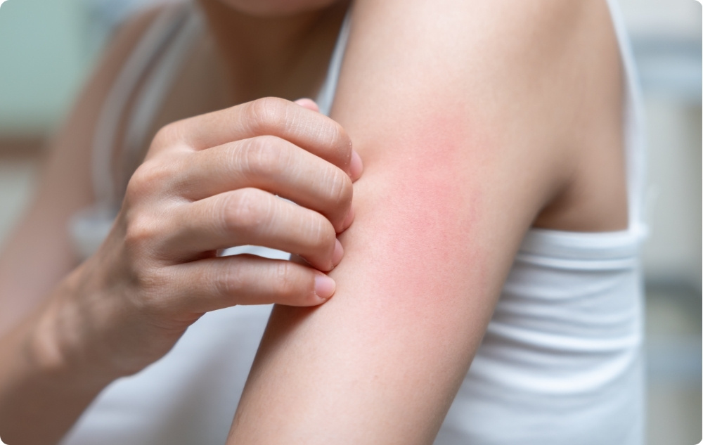 Som ett antiseptiskt och antiinflammatoriskt medel för irritationer och mindre sår