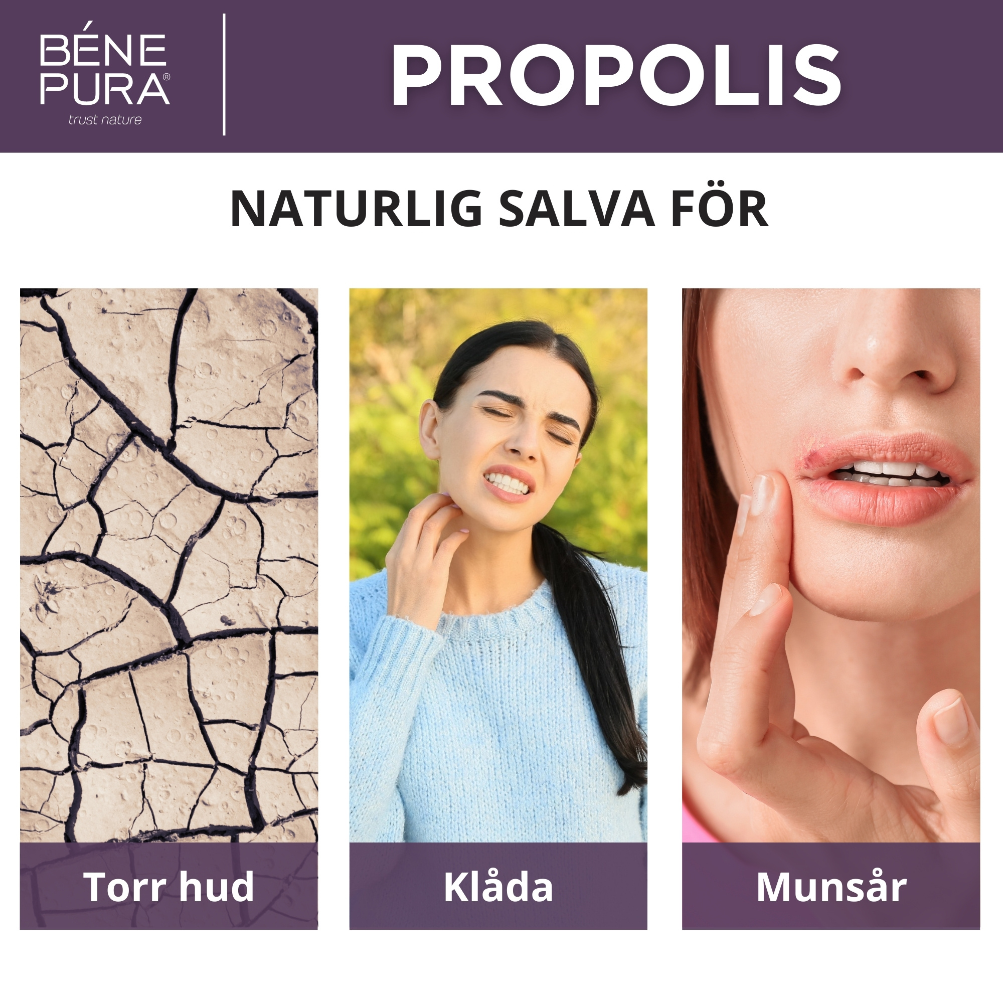 Klådsalva med 30% Propolis - 40ml