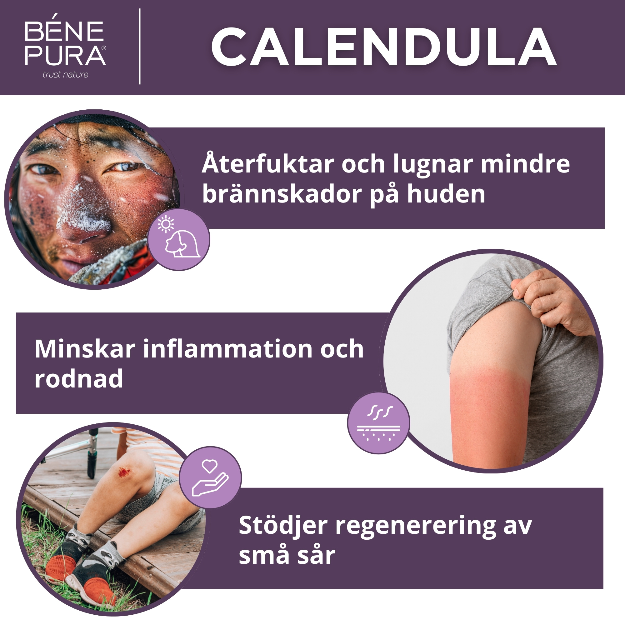 Bränn- och sårsalva med Ringblomma, Aloe Vera och Johannesört - 40ml