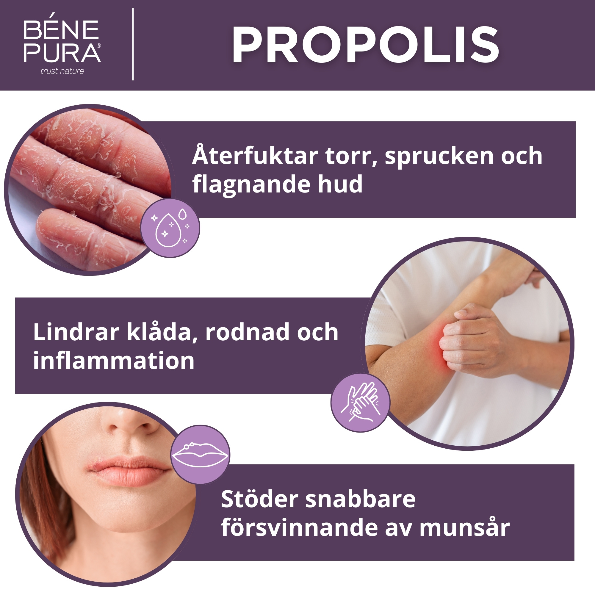 Klådsalva med 30% Propolis - 40ml