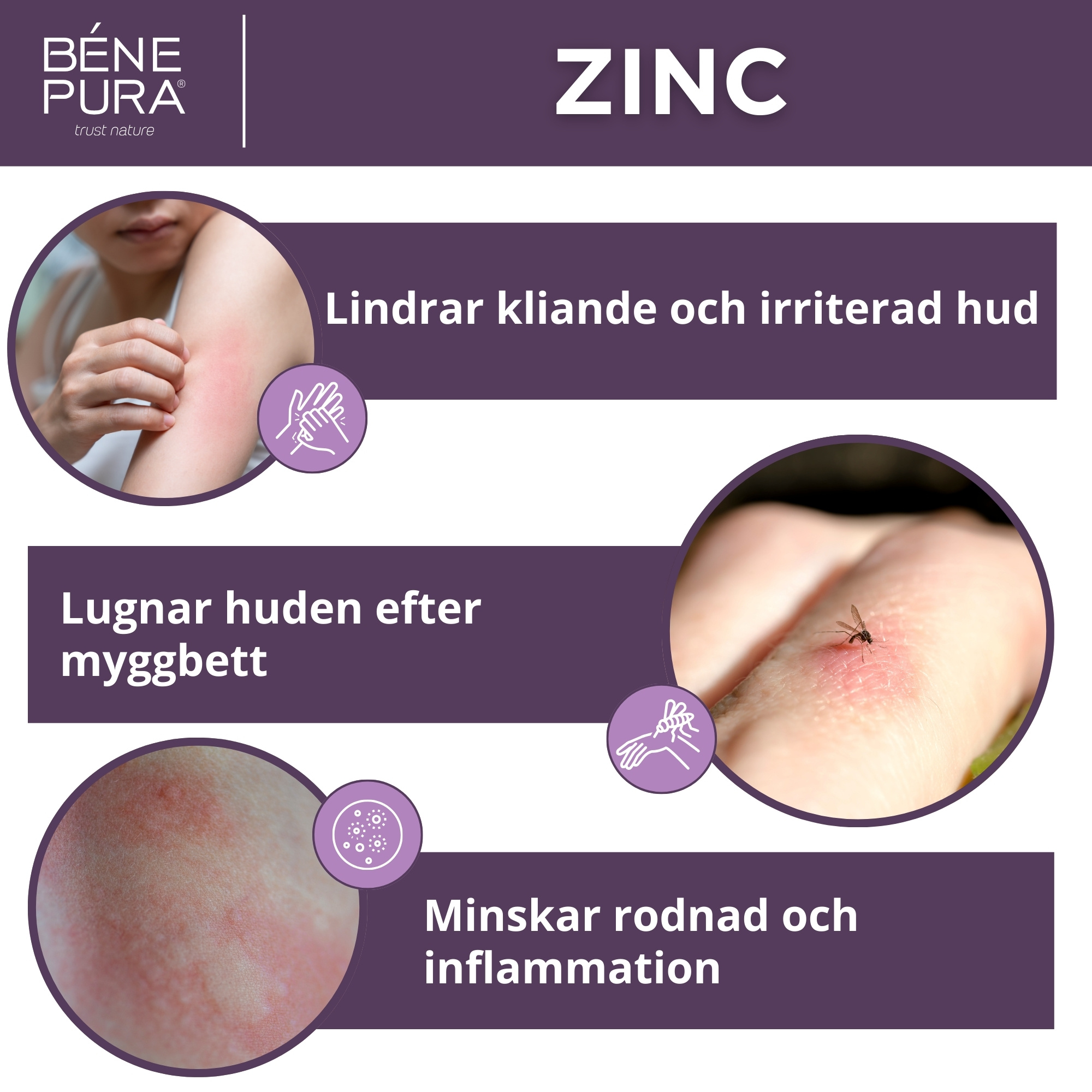 Klådsalva med Zinkoxid - 40ml